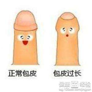 包皮过长的症状有哪些